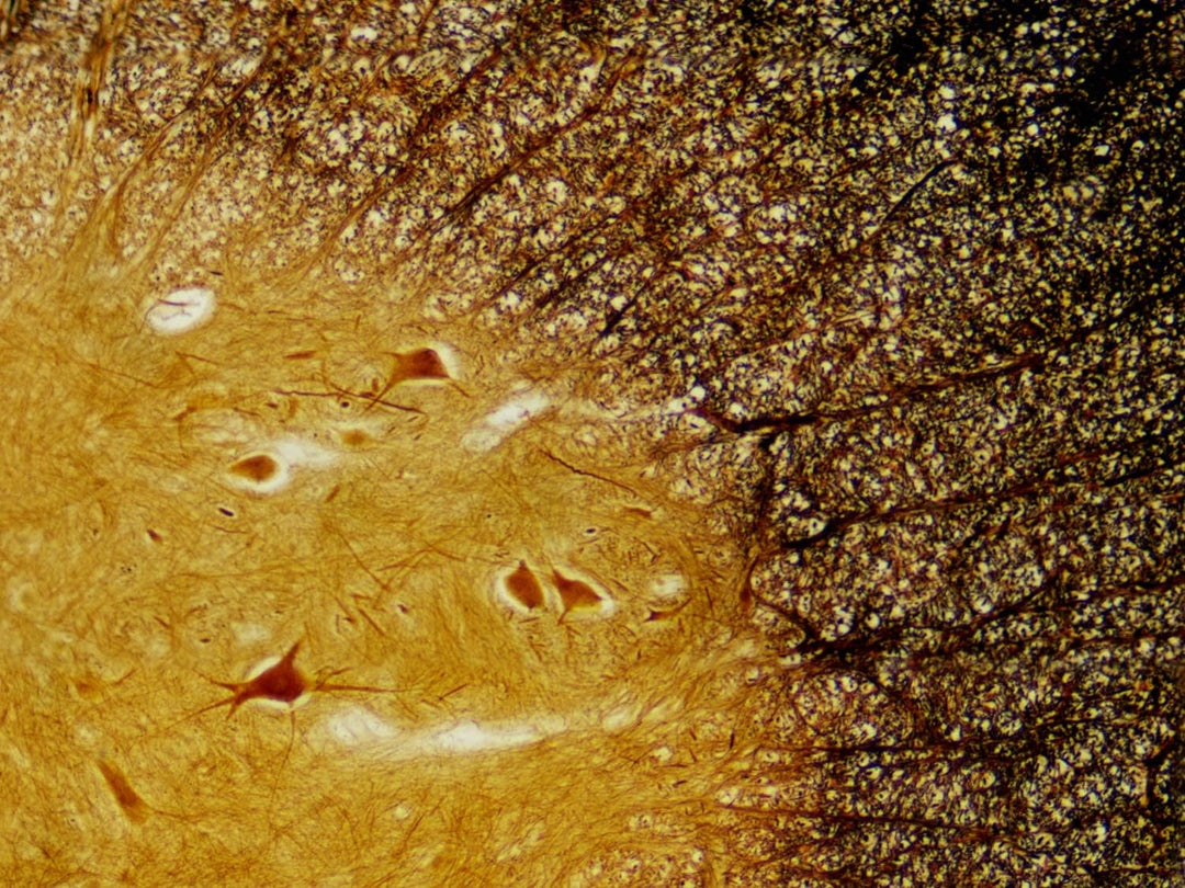 Bresser Mikroskop Dauerpräparate 30 Stück in Kunststoffbox, Lernpräparate aus der Biologie Single, S