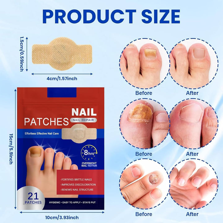42 Stück Nail Patches For Toenails & Fingernails,Mehrzweck Zehennagel Pads