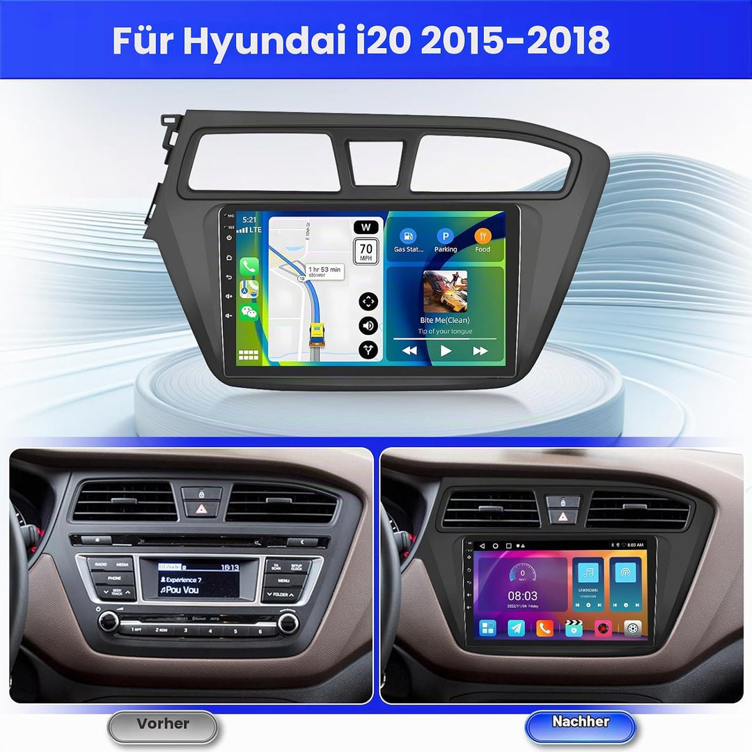 Android 15 Radio für Hyundai i20 2015-2018 2+64G mit Wireless CarPlay Android Auto, 9 Zoll Bildschir