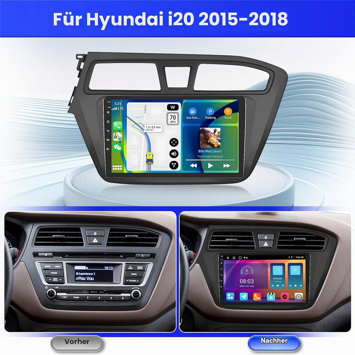 Android 15 Radio für Hyundai i20 2015-2018 2+64G mit Wireless CarPlay Android Auto, 9 Zoll Bildschir