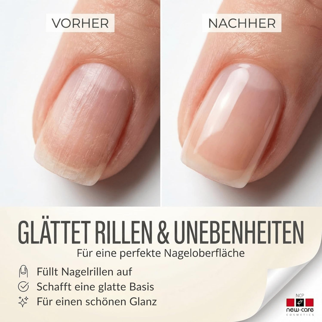 NCP new care Beauty Nail Wachstumslösung für Ebenmässige und Gestärkte Nägel – 10 ml – Tiefenwirksam