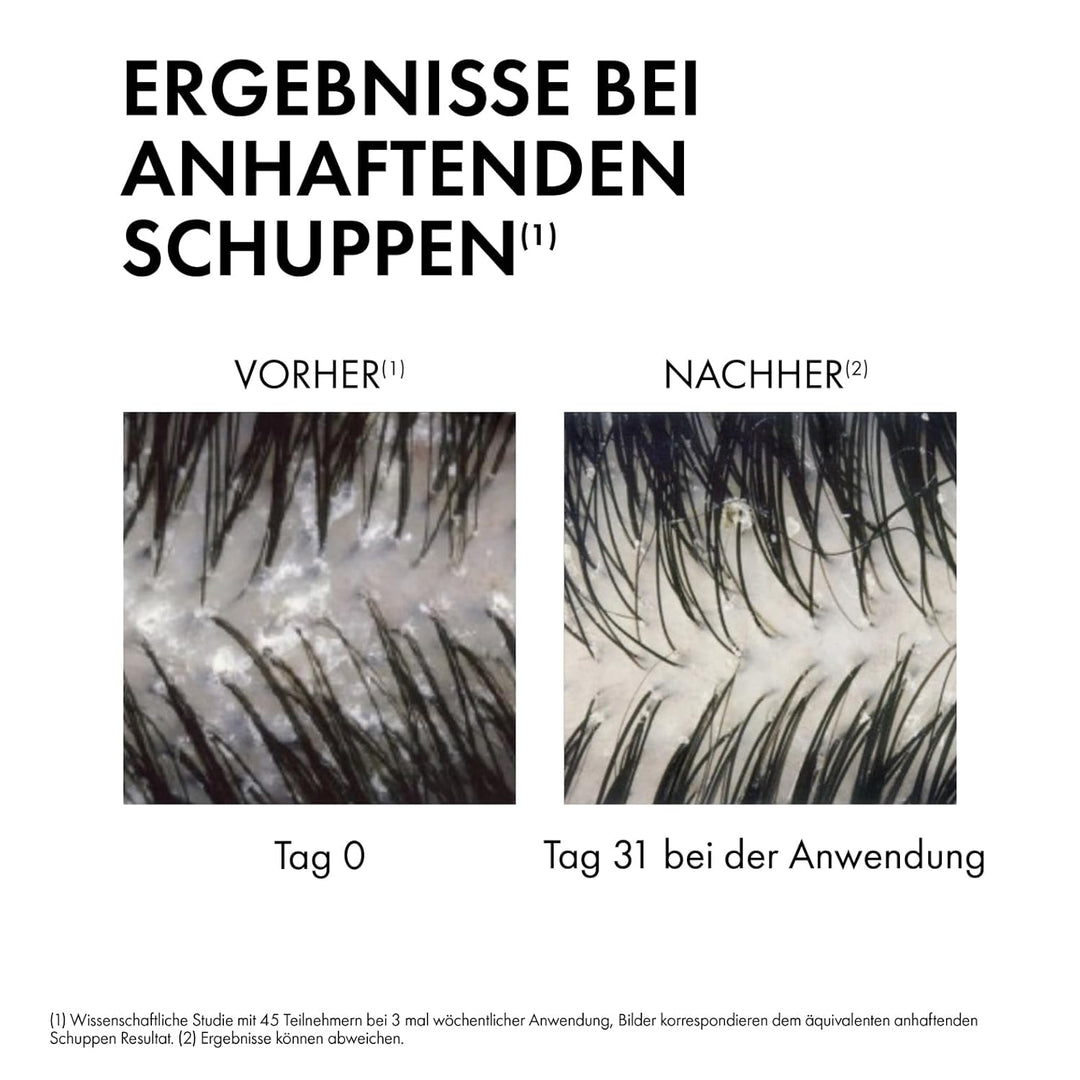 Vichy Dercos Anti-Schuppen Shampoo trocken