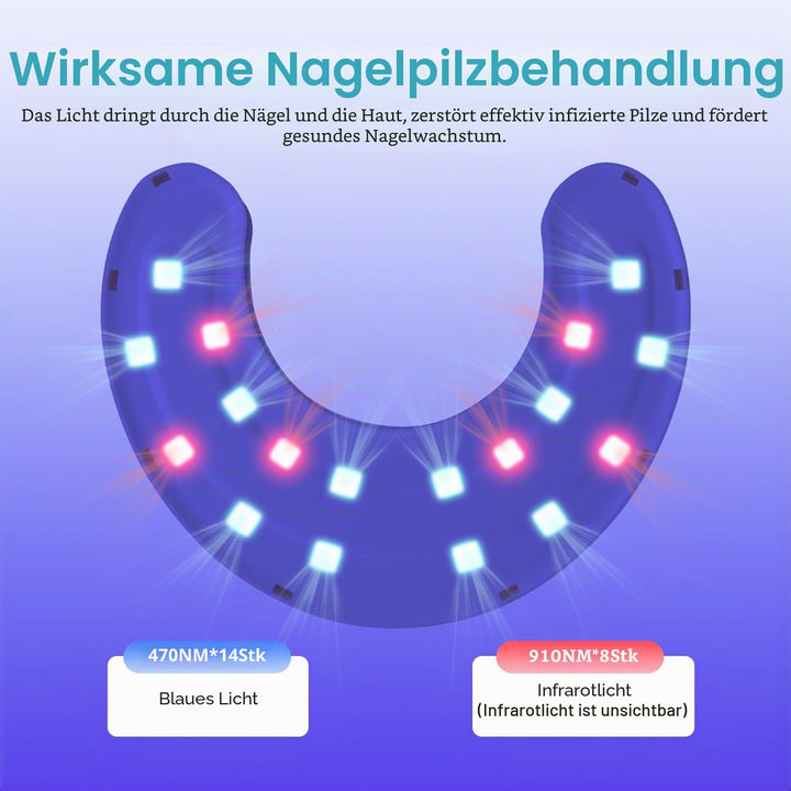 Lichtgerät zur Nagelpilz-Reinigung der 2. Generation für mehrere Zehen- und Fingernägel, Nagelrepara