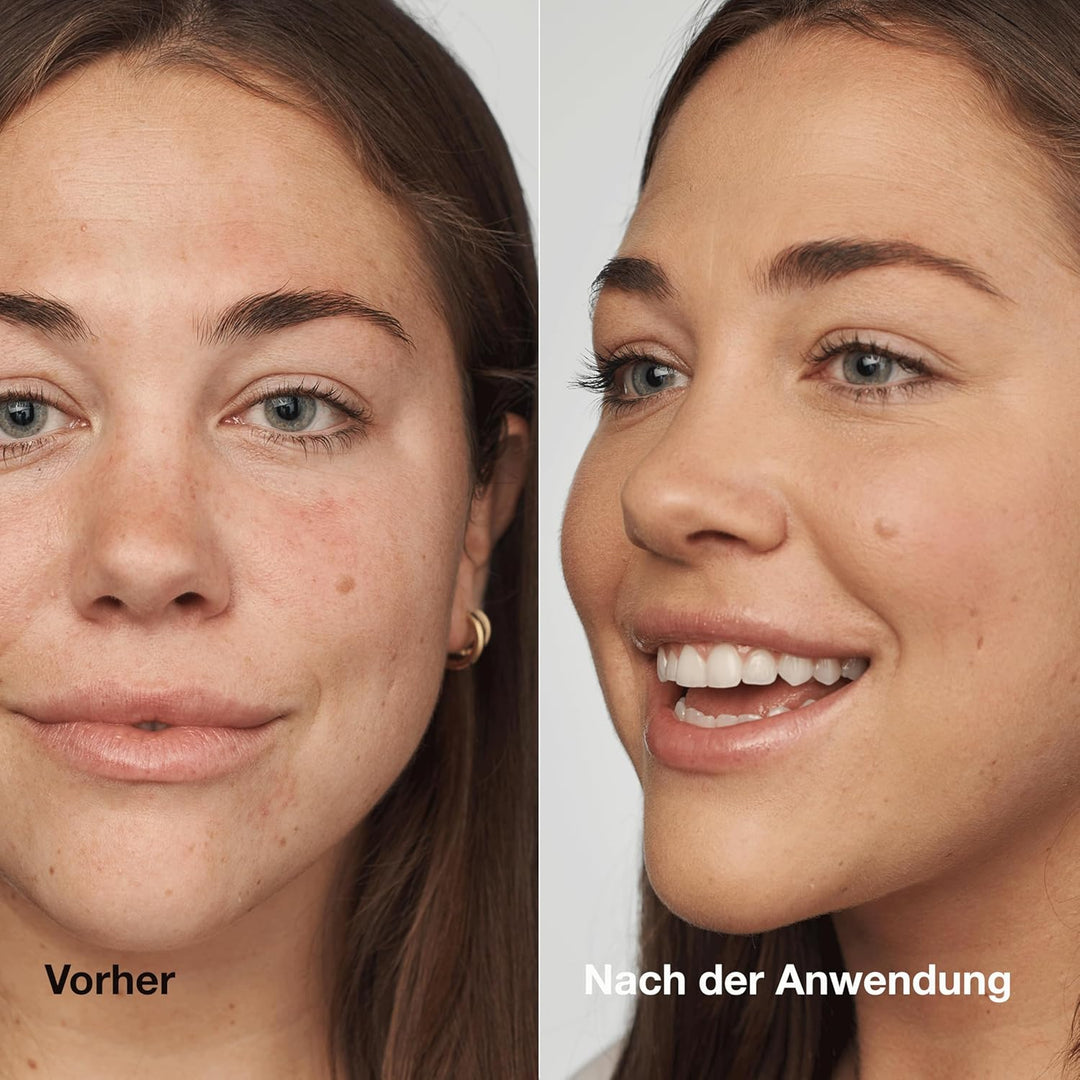 Clinique Even Better Cream Foundation Spf20Wn46-Golden 30 Ml 30 ml (1er Pack) Wn46-Golden, 30 ml (1e