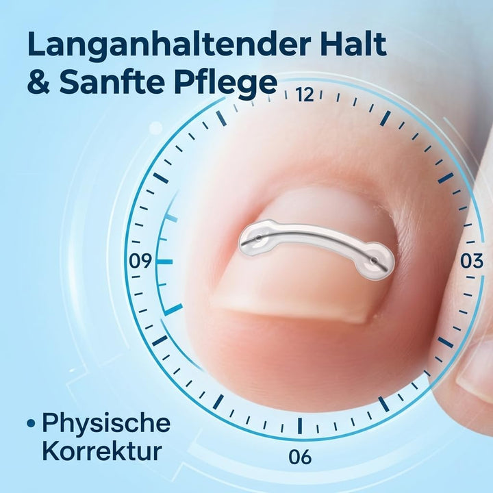 Eingewachsene Zehennägel Set Titan Nagelspange Fussnägel Korrektur, 10 Stück | 1er Pack, 5 Grössen 1