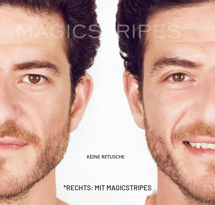 Magicstripes Augenlidkorrektur Grösse large, 64 Stück