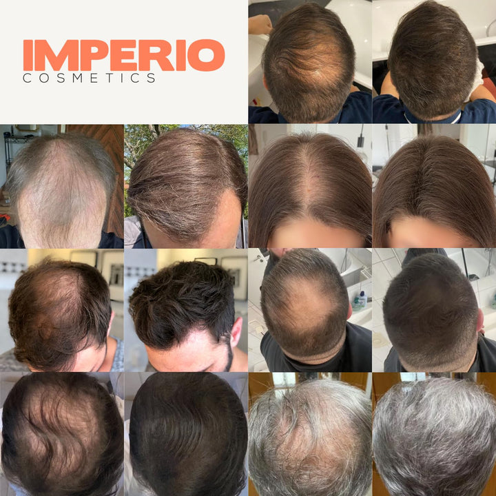 IMPERIO Streuhaar zur Haarverdichtung & vollem Haar in Sekunden. Schütthaar für einen authentischen