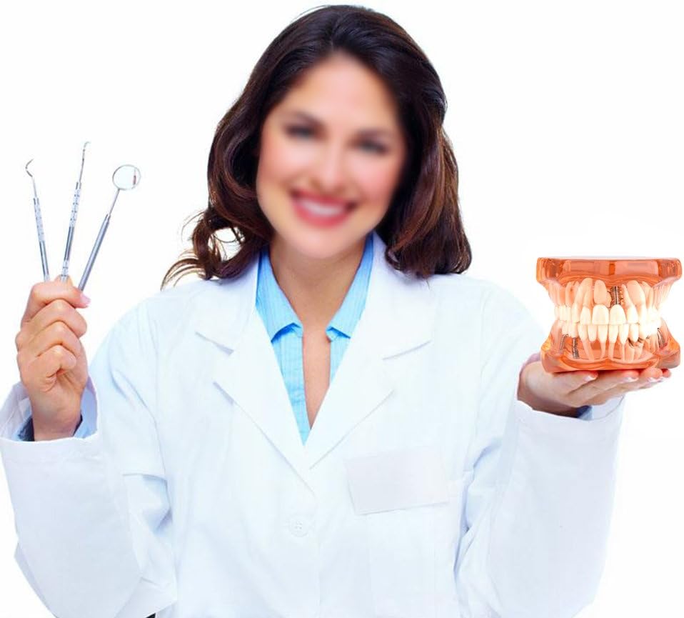 Jadeshay Zahnmodell Dentalmodell, Entfernbares Zahn-Implantat Lehrmodell Zahnarzt Demonstration Werk