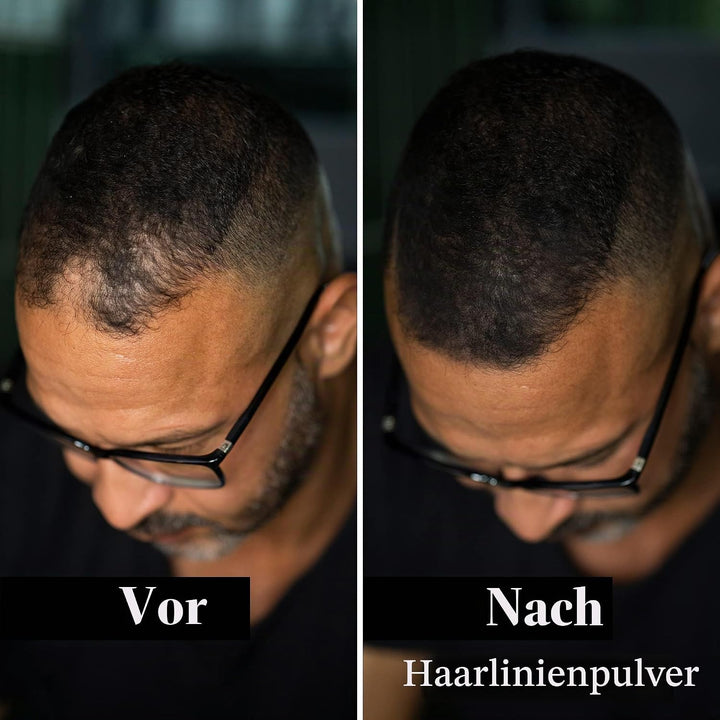 LEON MIGUEL Hair Fiber - Streuhaar - Premium Haarverdichtung/Schütthaar mit Soforteffekt bei Geheimr