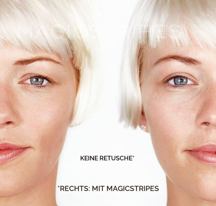 Magicstripes Augenlidkorrektur Grösse large, 64 Stück