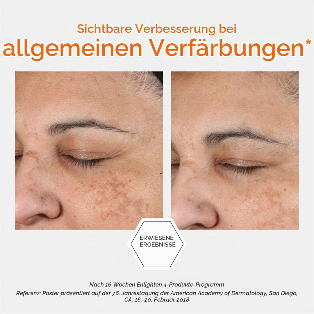 NEOSTRATA Enlighten Pigment Controller Nachtcreme für Pigmentflecken, 50 g