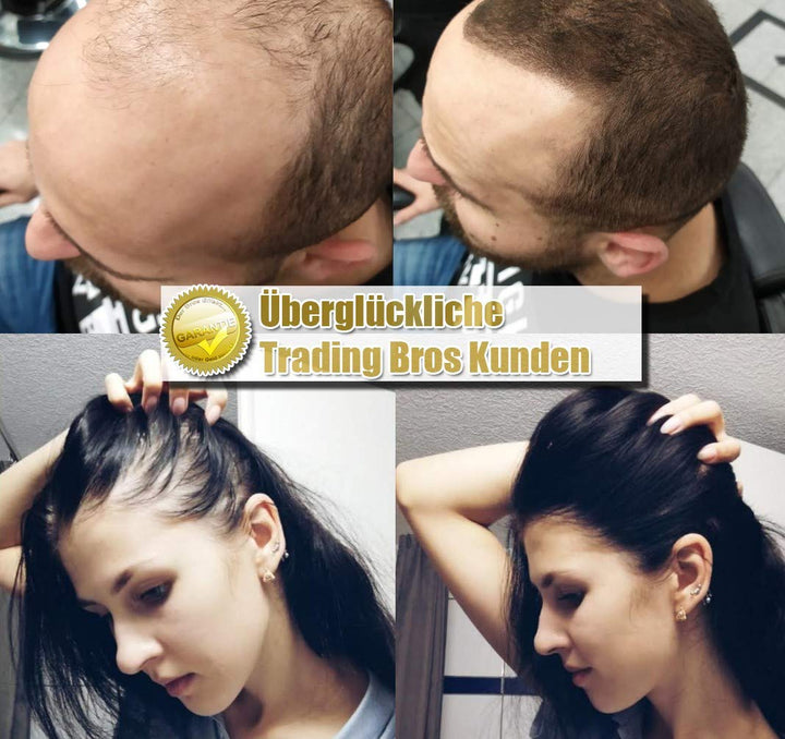 XXL Premium Streuhaar Schütthaar Haarverdichtung Trading Bros Magic Hair Fibers Mittelbraun 28g, Mit