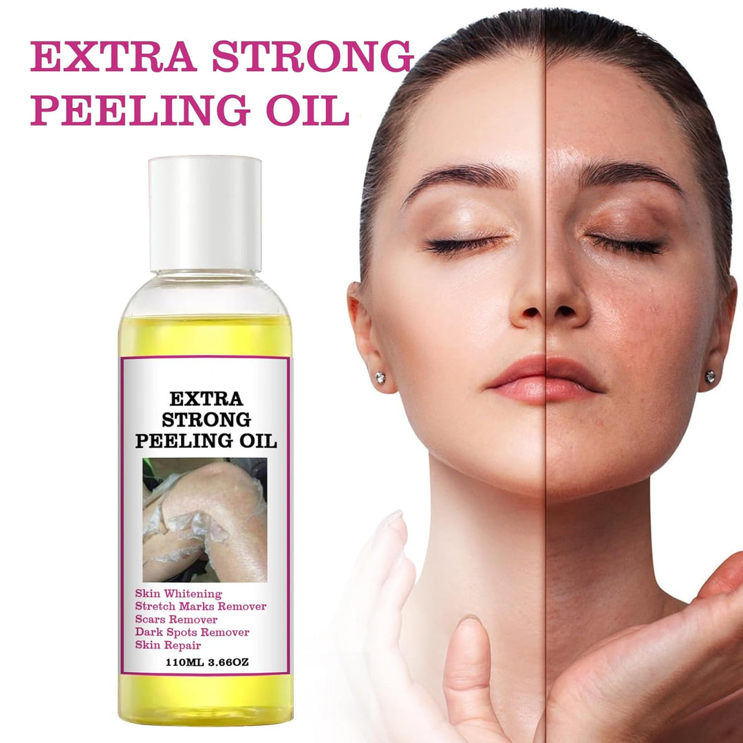 Extra Strong Gelbes Peeling Öl, 110ml Peeling-Öl Für Dunkle Haut Natural Spots Whitening Yellow Peel