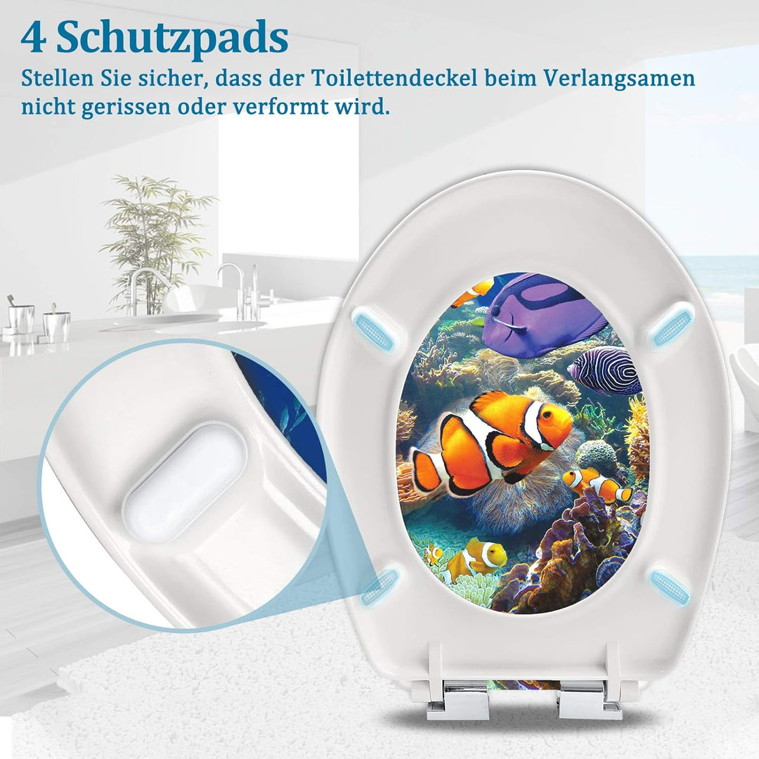YZNAHRE WC-Sitz Toilettendeckel mit Soft-Close, Duroplast &amp; Edelstahl, Antistatisch &amp; Antibakteriell