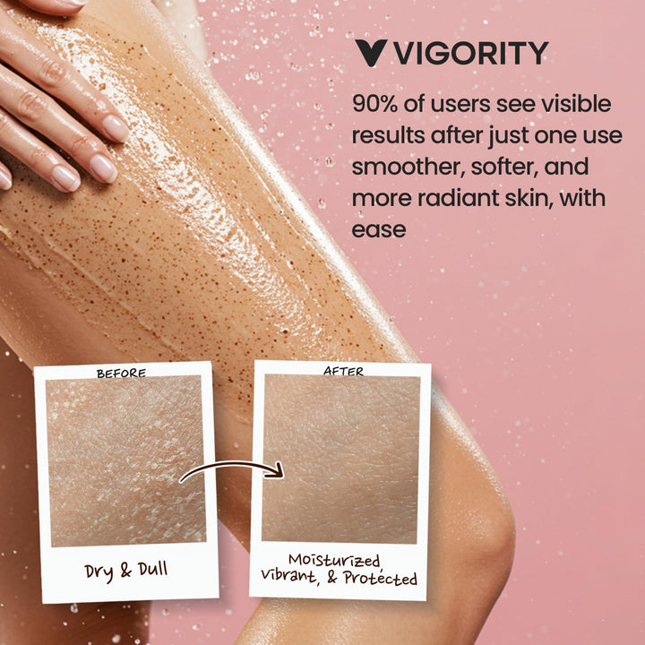 KP Bump Eraser Body Scrub, Bump Eraser Body Scrub, Keratosis Pilaris Treatment, Strawberry Legs Trea