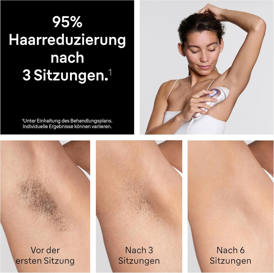 Braun Smart IPL Geräte Haarentfernung Skin i·expert 7 — Professionelle Dauerhafte Laser Haarentfernu
