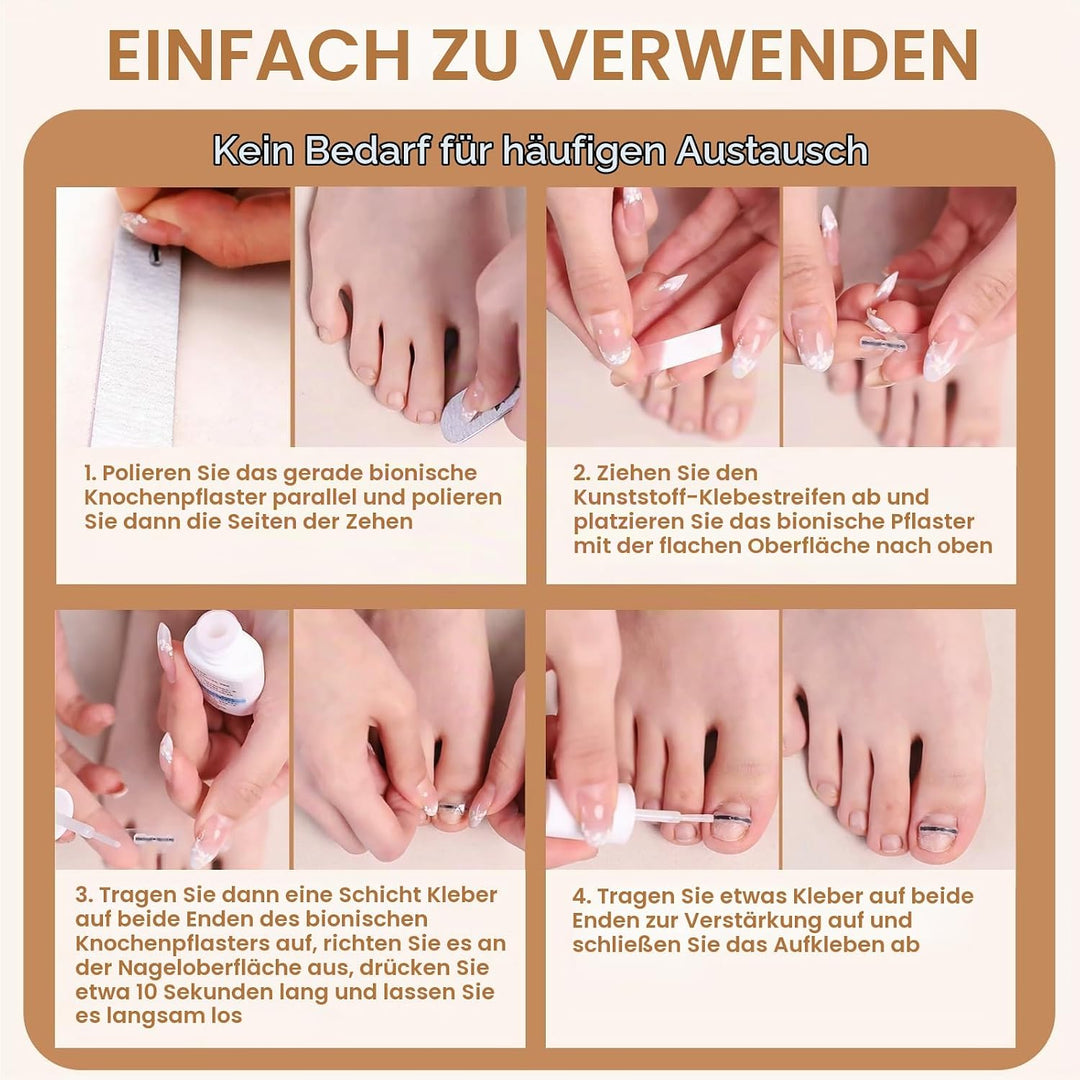 Eingewachsene Zehennägel Werkzeug Set, Nagel-korrekturspange, Zehennägel Korrektur Patch, Nagelspang