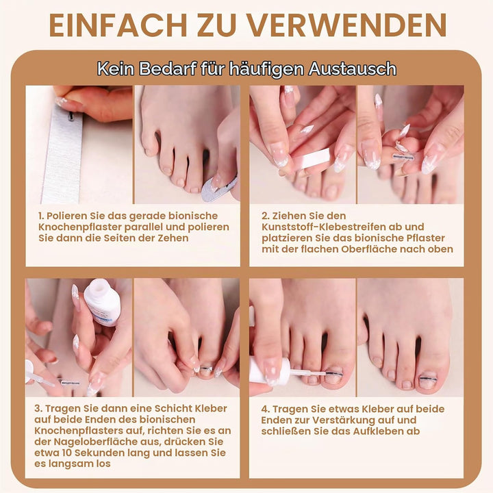 Eingewachsene Zehennägel Werkzeug Set, Nagel-korrekturspange, Zehennägel Korrektur Patch, Nagelspang