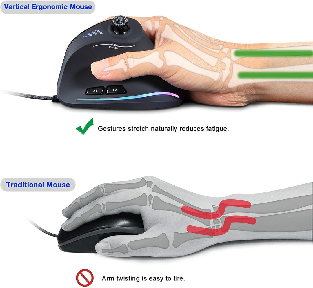 TKMARS Gaming Maus, Optische Vertical Gaming Mouse mit Joystick,Ergonomisches Design Vorbeugung gege