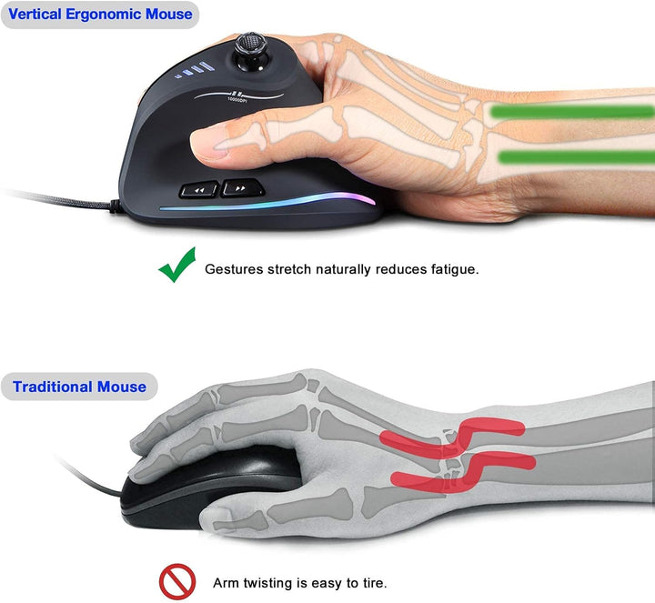 TKMARS Gaming Maus, Optische Vertical Gaming Mouse mit Joystick,Ergonomisches Design Vorbeugung gege