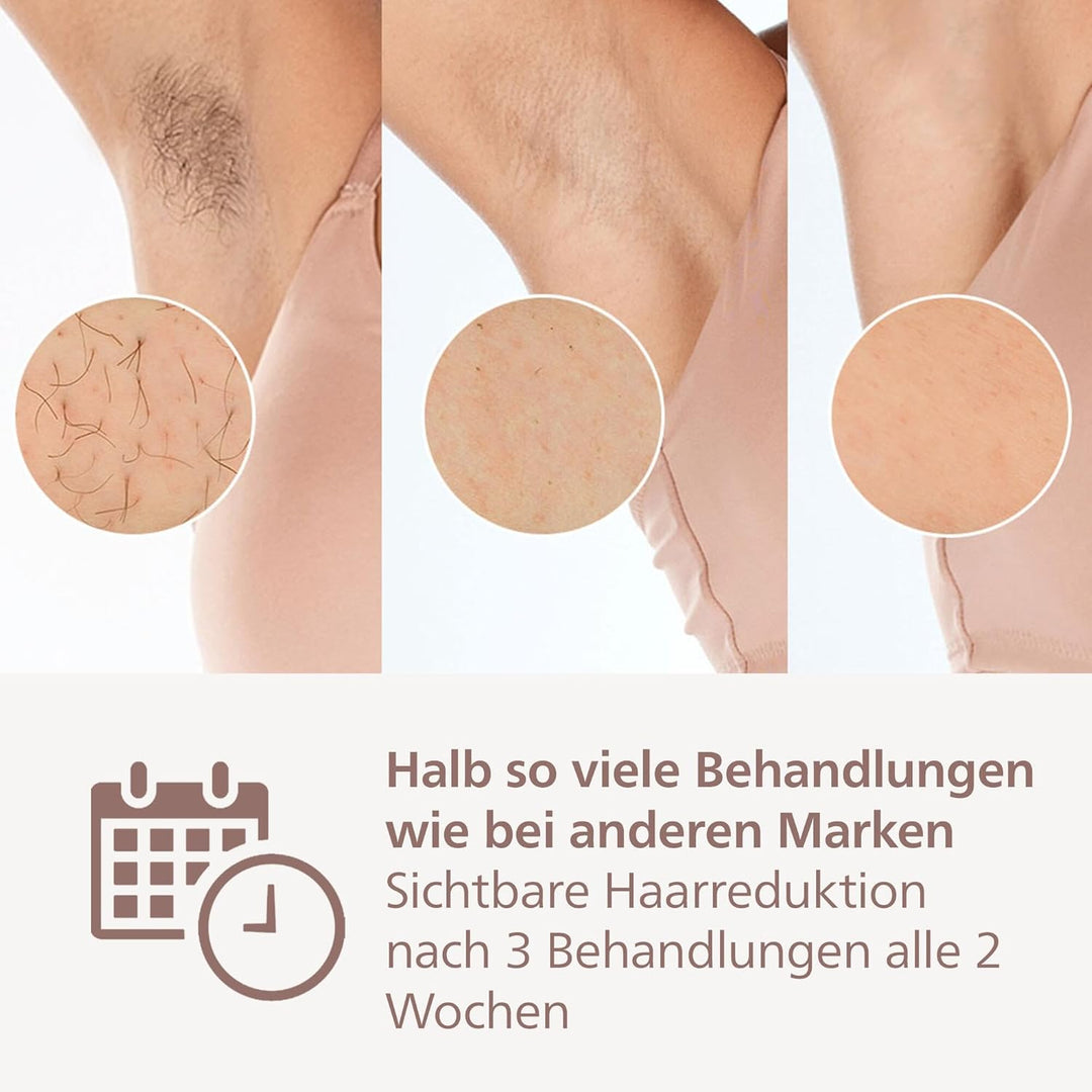 Philips Lumea 9900 Series, IPL-Haarentfernungsgerät, Alternative zur Laserhaarentfernung, SenseIQ un
