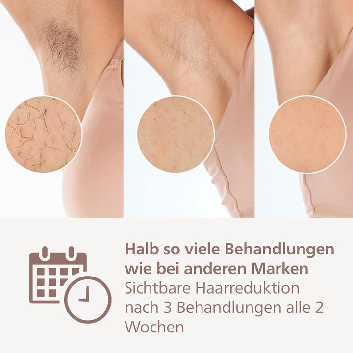 Philips Lumea 9900 Series, IPL-Haarentfernungsgerät, Alternative zur Laserhaarentfernung, SenseIQ un