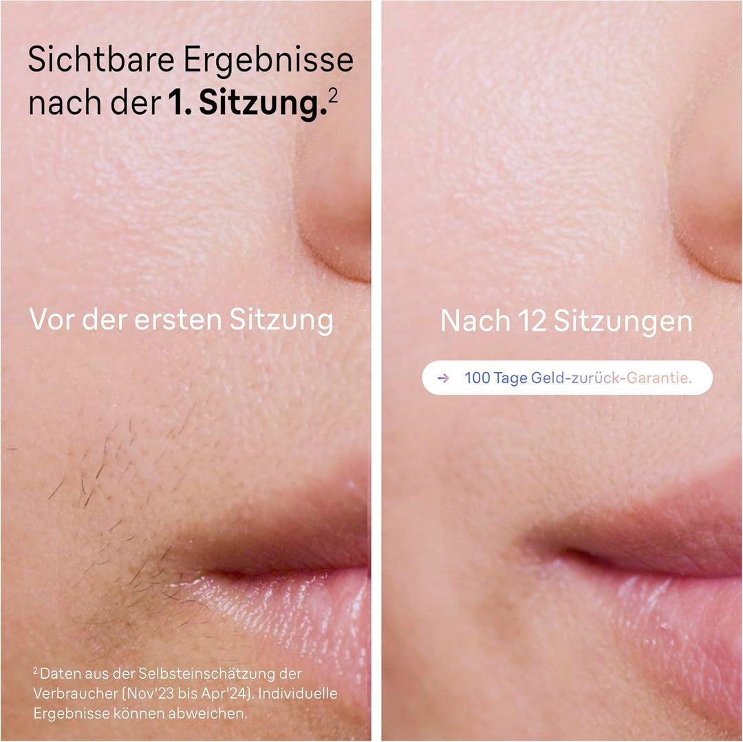 Braun Smart IPL Skin i·expert, Haarentfernung für zu Hause, Gratis App, Aufbewahrungstasche, Venus R