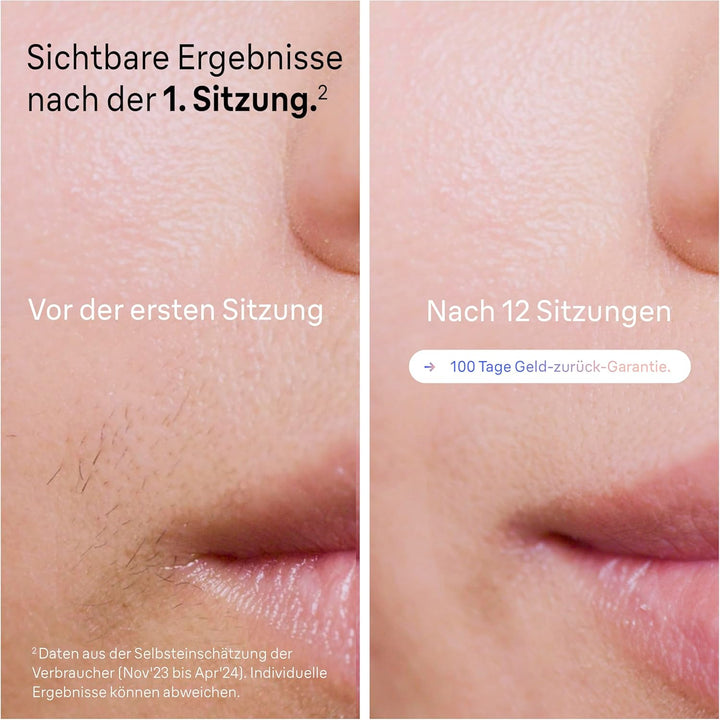 Braun Smart IPL Skin i·expert, Haarentfernung für zu Hause, Gratis App, Aufbewahrungstasche, Venus R