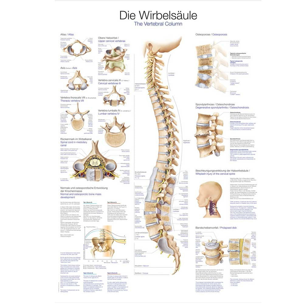Unbekannt Lehrtafel „Die Wirbelsäule“, 50x70cm, Kunstdruckpapier 50 cm x 70 cm, 50 cm x 70 cm