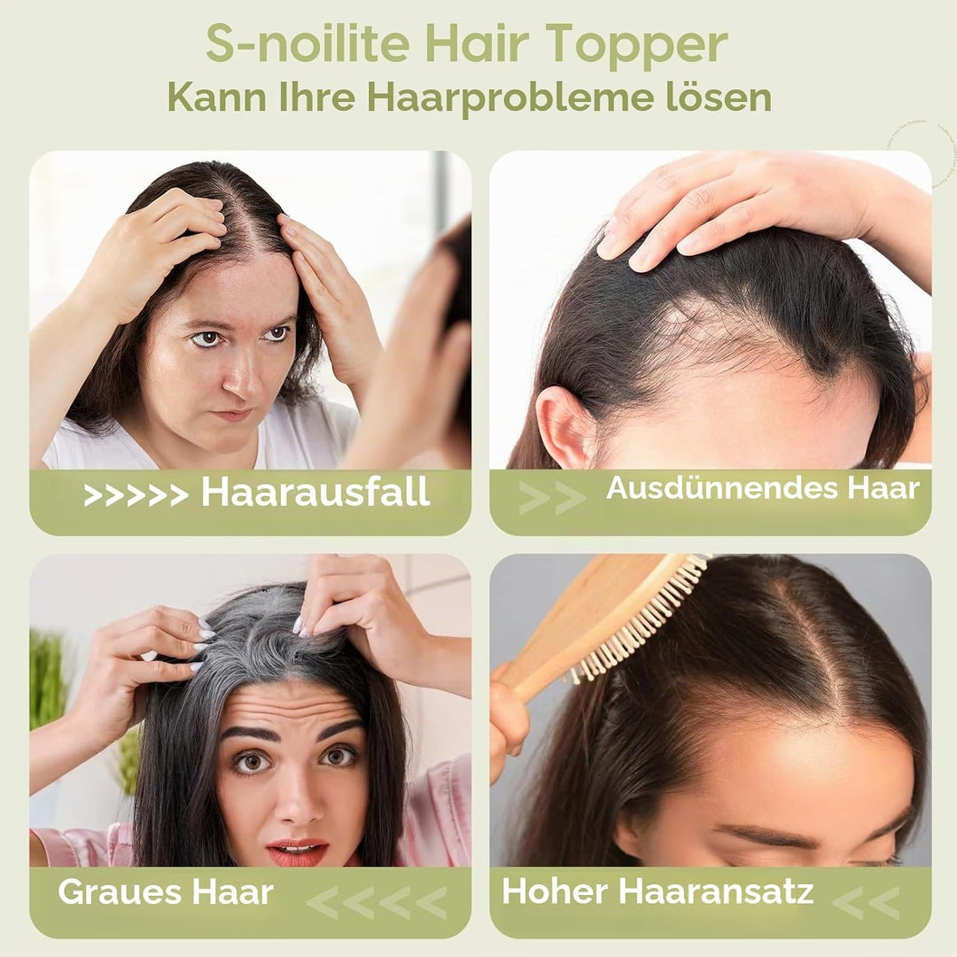 S-noilite Echthaar Hair Topper für Frauen mit Pony Haarteile für Dünnes Haar Echtes Menschliches Haa