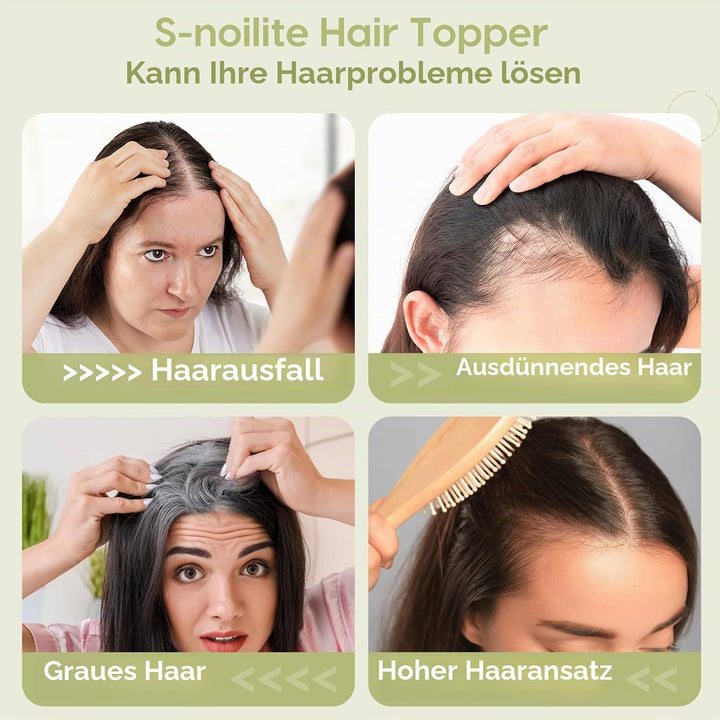 S-noilite Echthaar Hair Topper für Frauen mit Pony Haarteile für Dünnes Haar Echtes Menschliches Haa