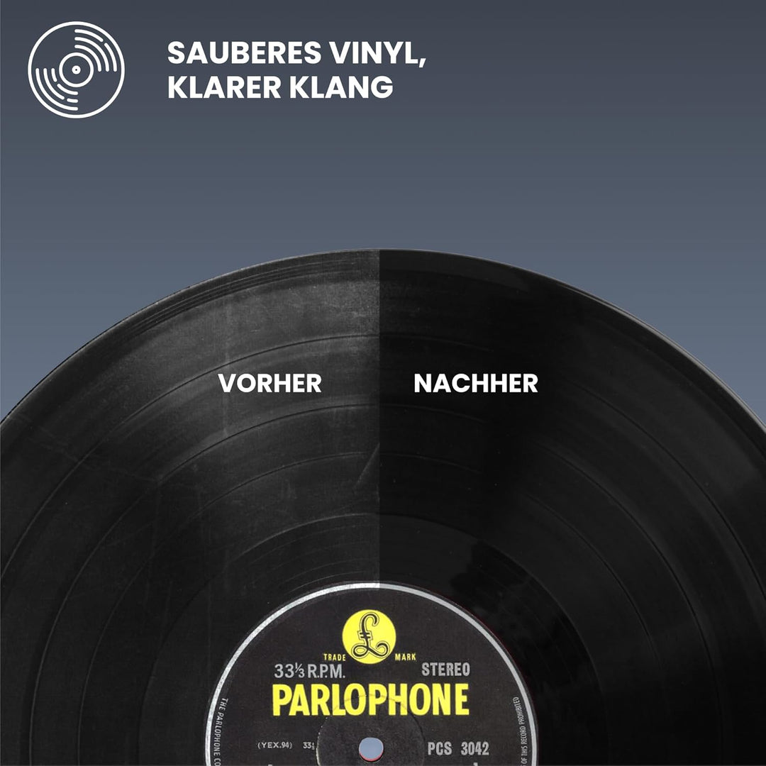Big Fudge 4-in-1-Reinigungsset für Vinyl Schallplatten – Schallplatten Reinigung inkl. weicher, krat