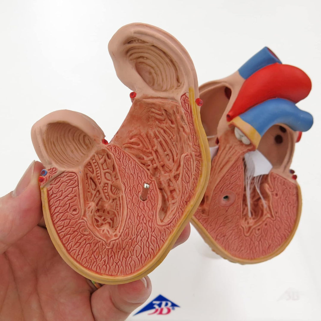 3B Scientific Menschliche Anatomie - Klassik-Herzmodell mit linksventrikulärer Hypertrophie (LVH), 2