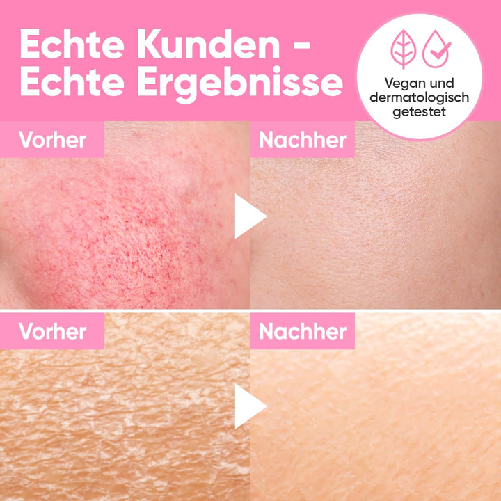 âme pure® Don't Be Thirsty Serum - Intensive Feuchtigkeitsversorgung für pralle, gepflegte Haut