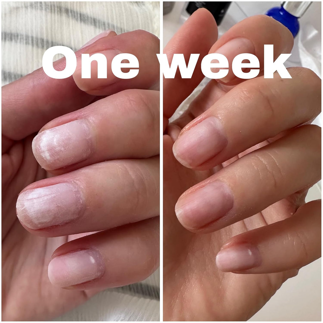 Elegans Nagelserum zur Stärkung & Regeneration – Nagelpflege für brüchige & strapazierte Nägel – ide