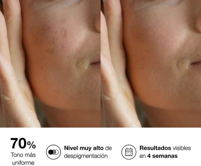 BIO 10 FORTE 3 en 1 corrector local SPF50 10 ml