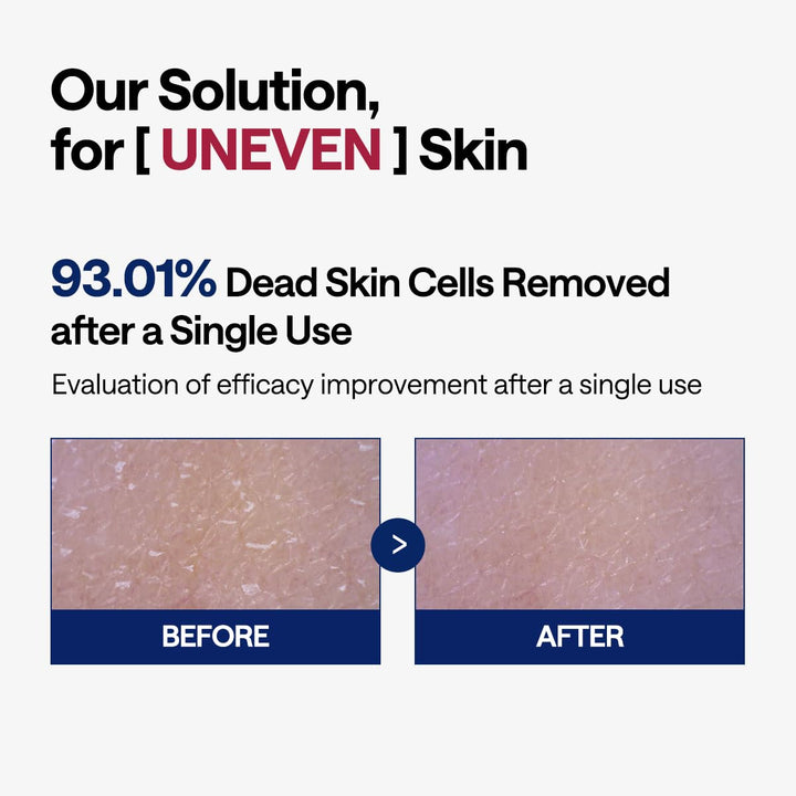 MEDIHEAL Phyto Enzym-Peeling-Pad – Vegane Gesichtserneuerung Gaze-Pads mit LHA & Papaya Enzym – Pore