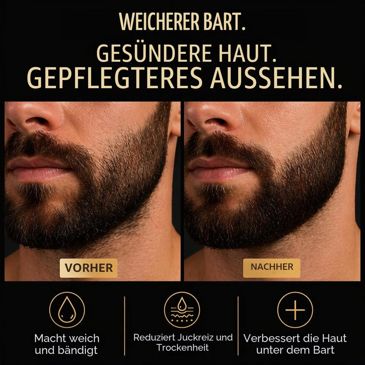 Bartöl Herren – Premium Bartpflege Öl Männer gegen Juckreiz, Bartschuppen & trockene Haut – Natürlic