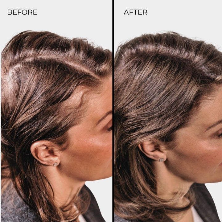 Nanogen Hair Thickening Fibres Light Brown 30g hellbraun 30g, hellbraun 30g