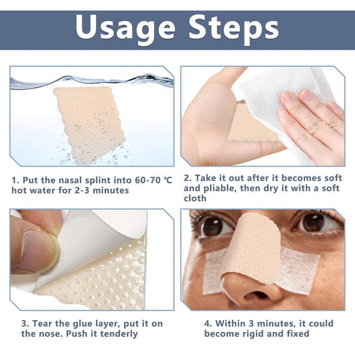 Thermoplastische Nasenschienen, externe Nasenstützung, Schutz für Nasenbandage, Rhinoplastie, Septop