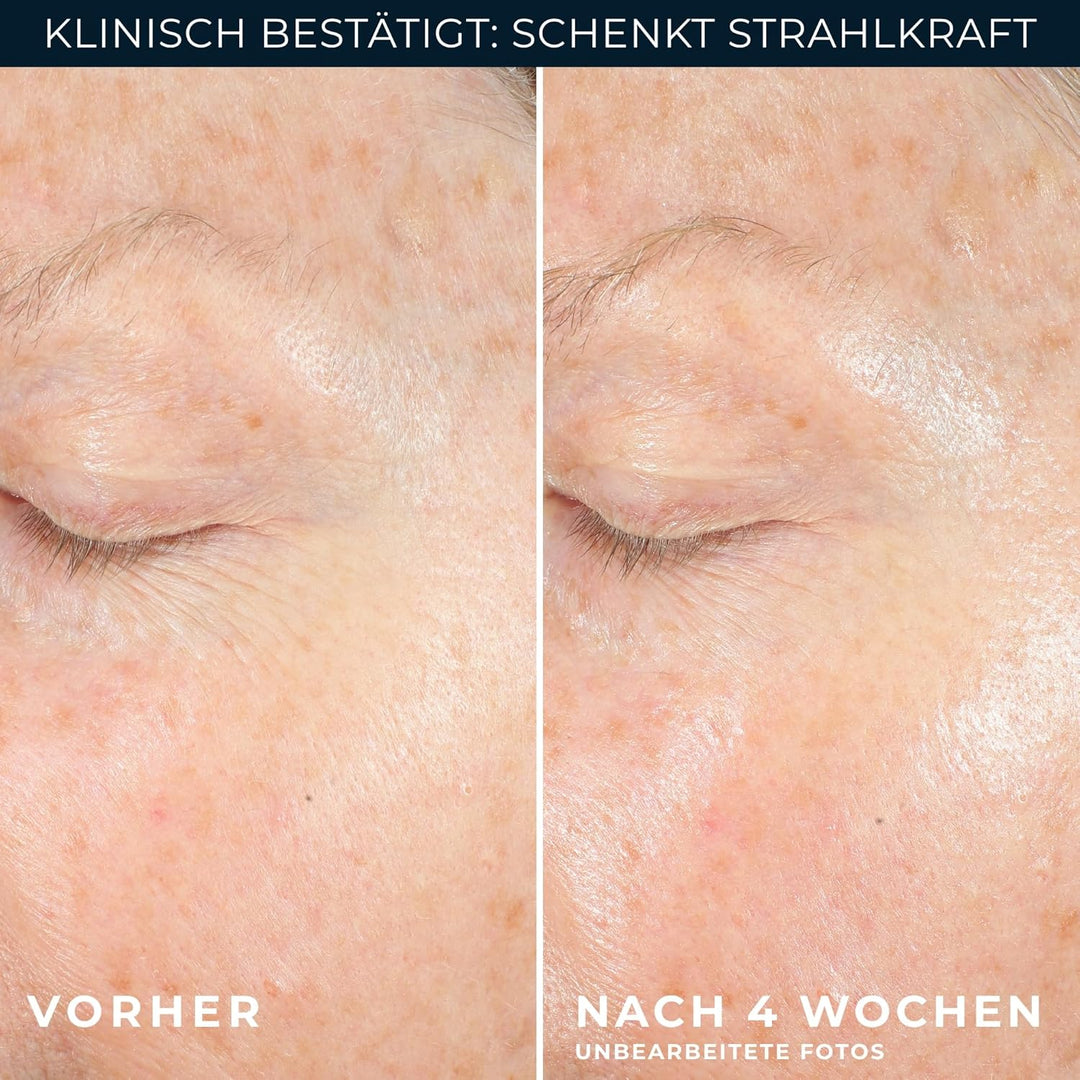 RoC - Multi Correxion Revive + Glow Vitamin C Gel-Creme - Anti Falten und Altern - Straffende Feucht