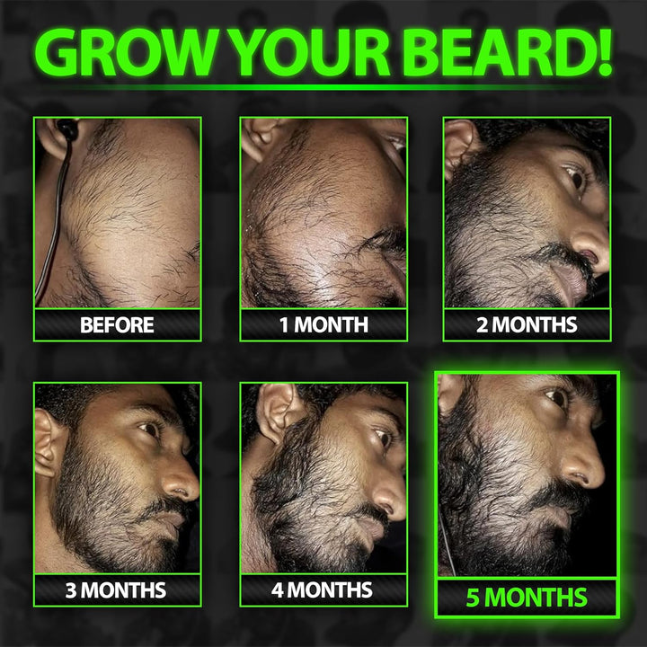 GROW Maximum XXL Beard Growth &amp; Mustache Accelerator Serum - Beard Growth Oil for Men to Fix Patchy