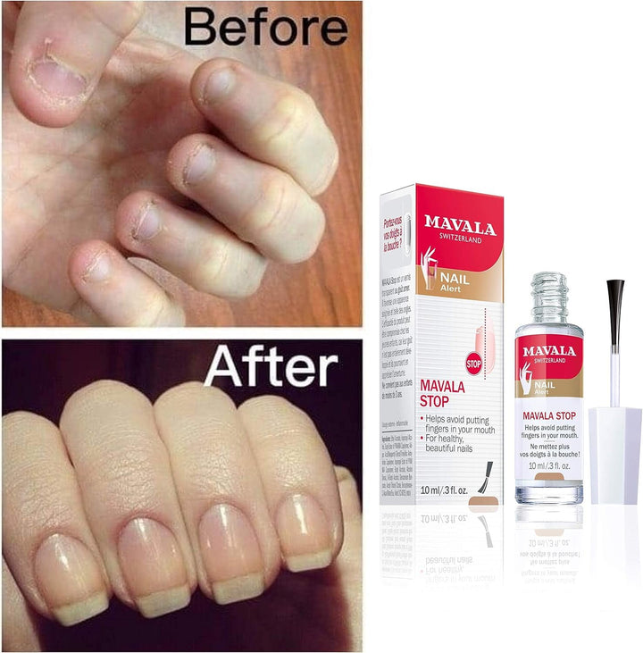 MAVALA 2 Stück Mavala Stop für Nagelbeissen und Daumensaugen, je 10 ml/8,5 g 10 ml (2er Pack), 10 ml