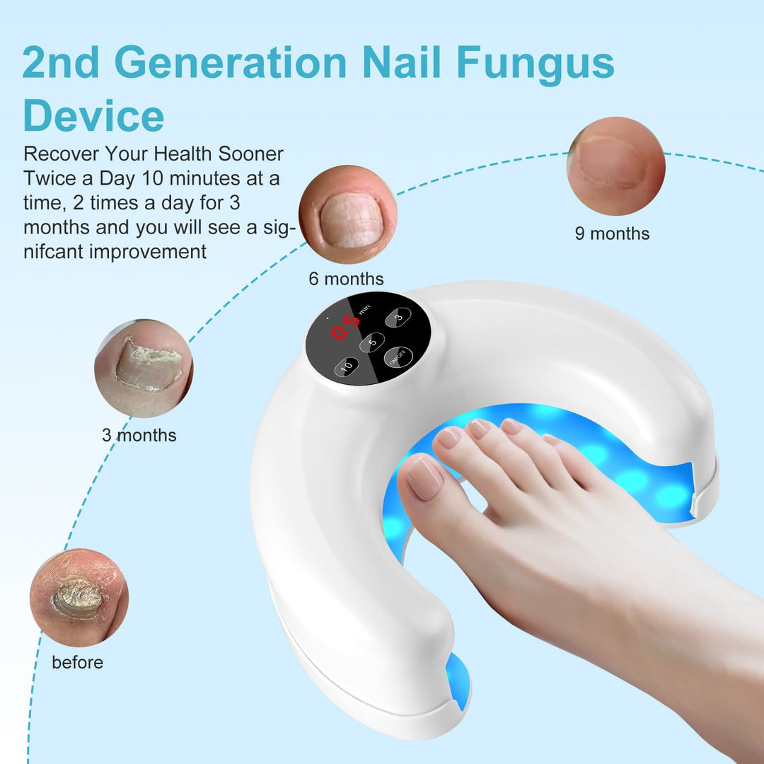 Lichtgerät zur Nagelpilz-Reinigung der 2. Generation für mehrere Zehen- und Fingernägel, Nagelrepara
