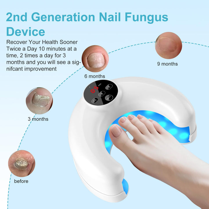 Lichtgerät zur Nagelpilz-Reinigung der 2. Generation für mehrere Zehen- und Fingernägel, Nagelrepara
