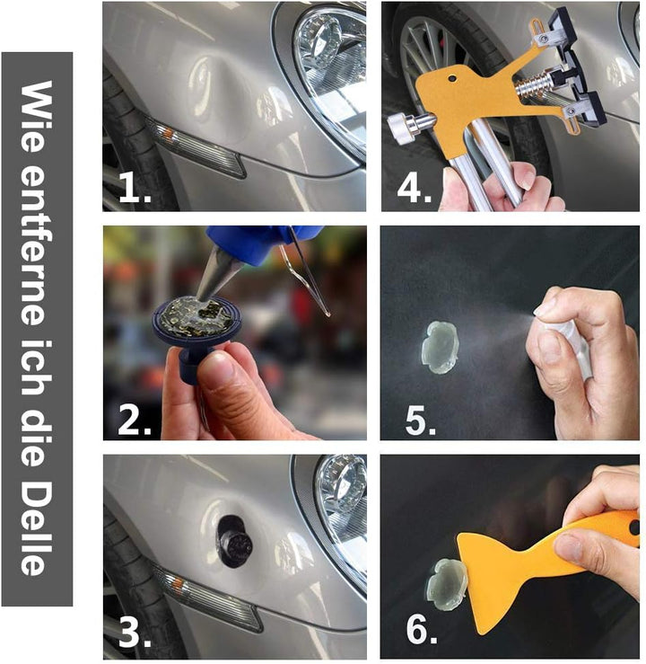 Manelord Dellen Reparatur Ausbeulwerkzeug Lackfreies Dent Puller Set, Dellen Reparaturset, Auto Pain