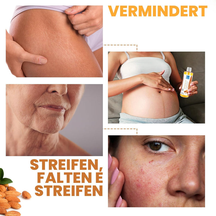 bleu &amp; marine Bretania - 100% Natürliches Mandelöl | Kaltgepresst | Anti-Dehnungsstreifen | Säugling