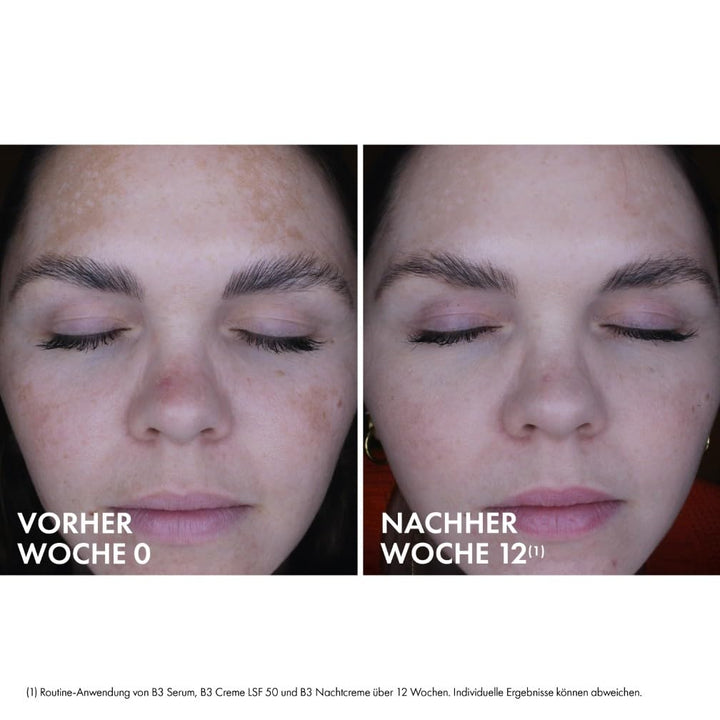 Vichy LiftActiv B3 Dark Spot Corrector und Gesichtsserum mit Niacinamid, Glykolsäure, Peptiden und T