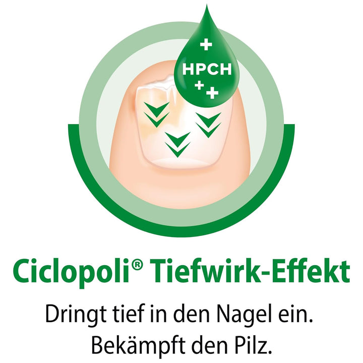 Ciclopoli gegen Nagelpilz, bei Pilzerkrankungen der Nägel, Anti-Pilz-Nagellack mit bewährtem Wirksto