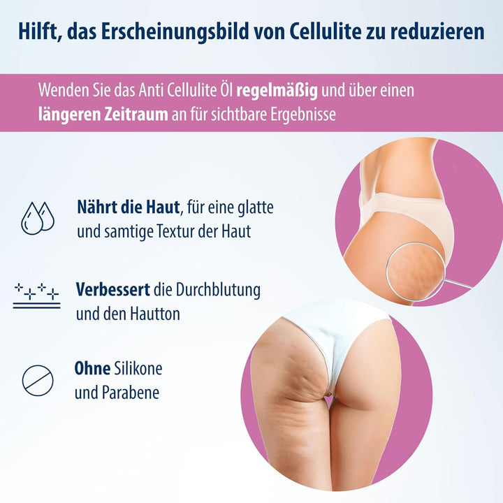Evolsin® Anti Cellulite Öl für Bauch Beine Po- reduziert Cellulite / Orangenhaut - zu 99% NATÜRLICHe